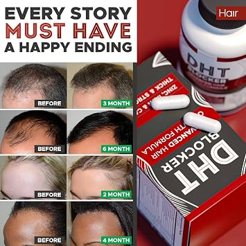 Hair care complex that strengthens roots and thickens strands | fights hair loss | unisex
