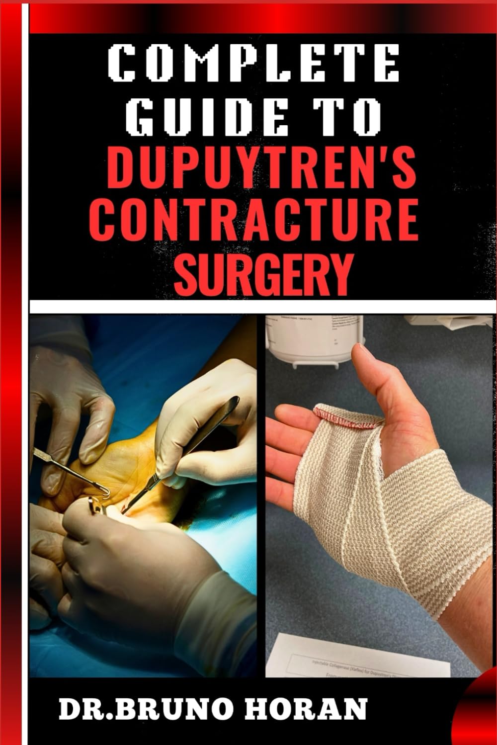 COMPLETE GUIDE TO DUPUYTREN’S CONTRACTURE SURGERY: Comprehensive Manual To Advanced Techniques, Recovery, and Best Practices for Optimal Oral Health