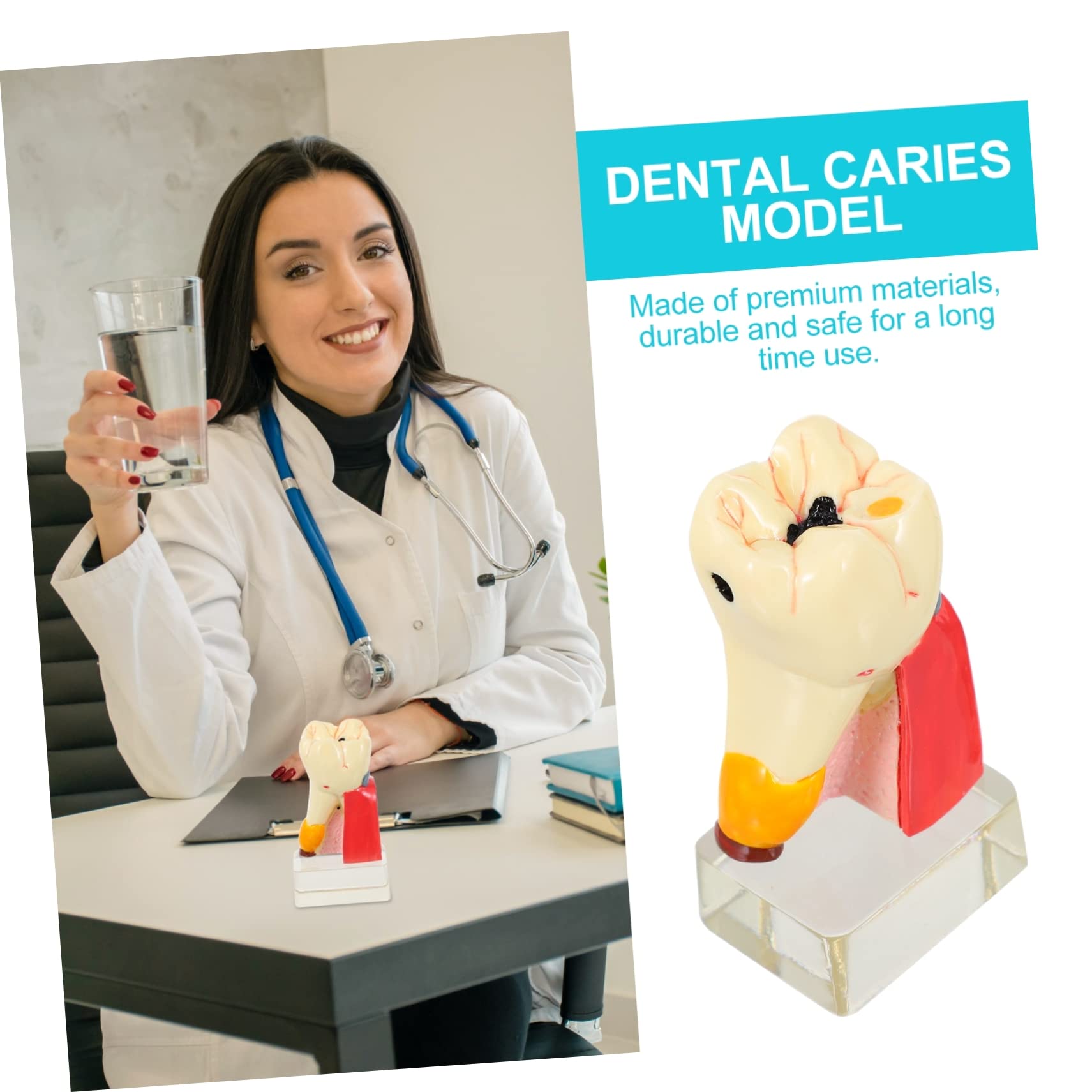 Modello Anatomico del Dente 4x per Carie, Resina, Didattico | Beige, per Dimostrazione e Insegnamento Odontoiatrico, Formato Compatto per Studio e Spiegazione