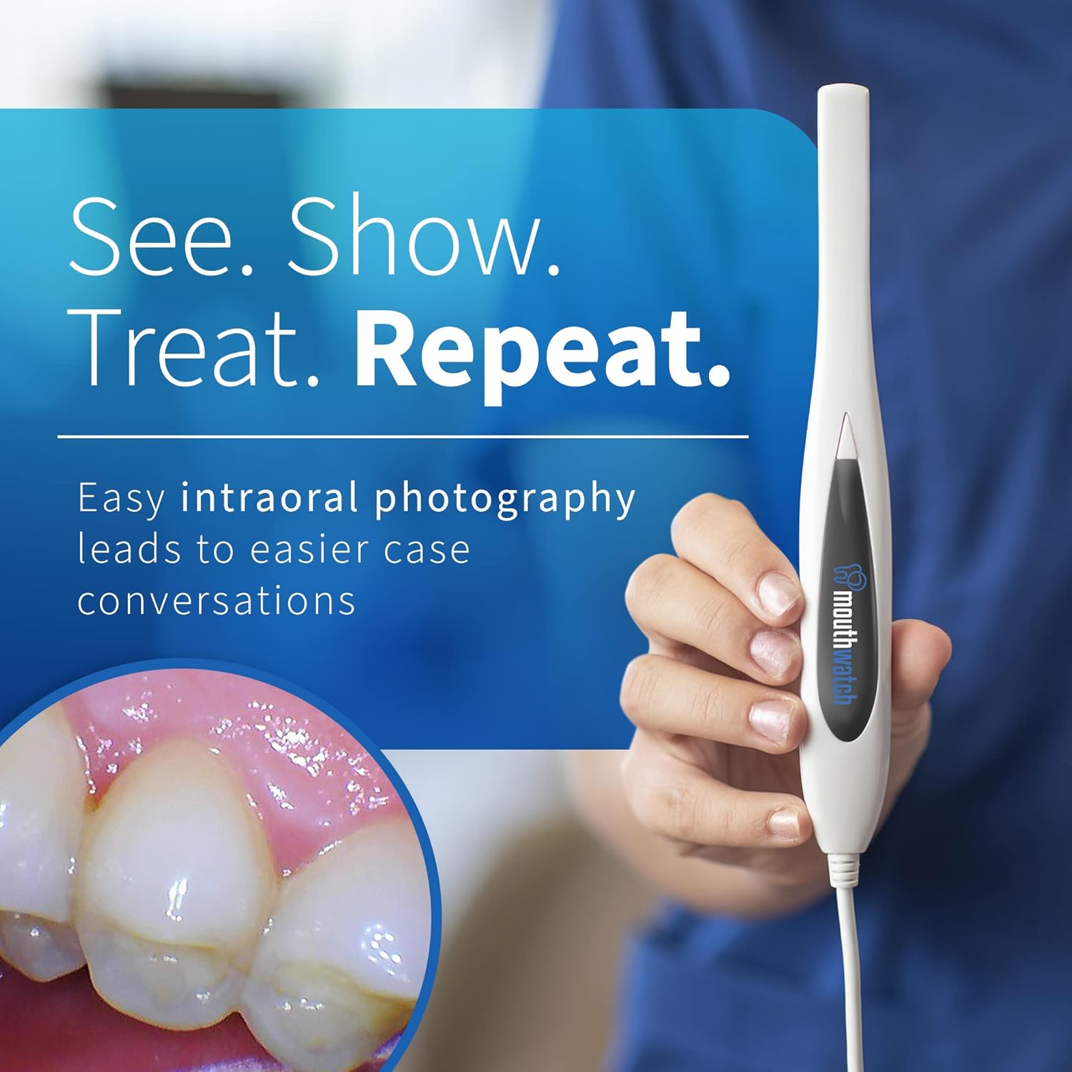 Intraoral Camera, Crystal Clear Images with an Easy to Use, Fast, Single Button Operation Dental Camera, Compatible with Over 50 Dental Imaging Suites, Lightweight and Ergonomic, 31 Grams - Image 2