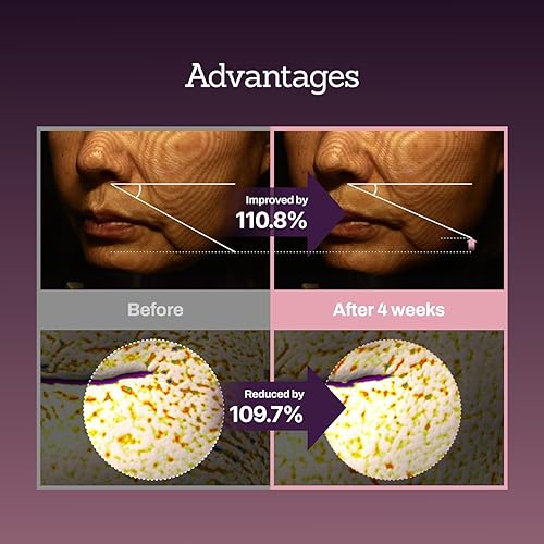 Miniatura 6 de Suero potenciador de péptido de colágeno 12X, mejora la elasticidad de la piel y reduce las arrugas profundas, promueve la producción de colágeno