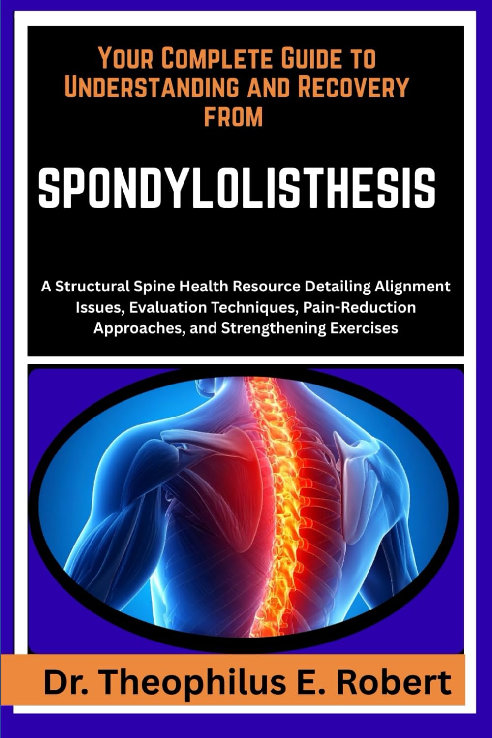 YOUR COMPLETE GUIDE TO UNDERSTANDING AND RECOVERY FROM SPONDYLOLISTHESIS: A Structural Spine Health Resource Detailing Alignment Issues, Evaluation ... Approaches, and Strengthening Exercises