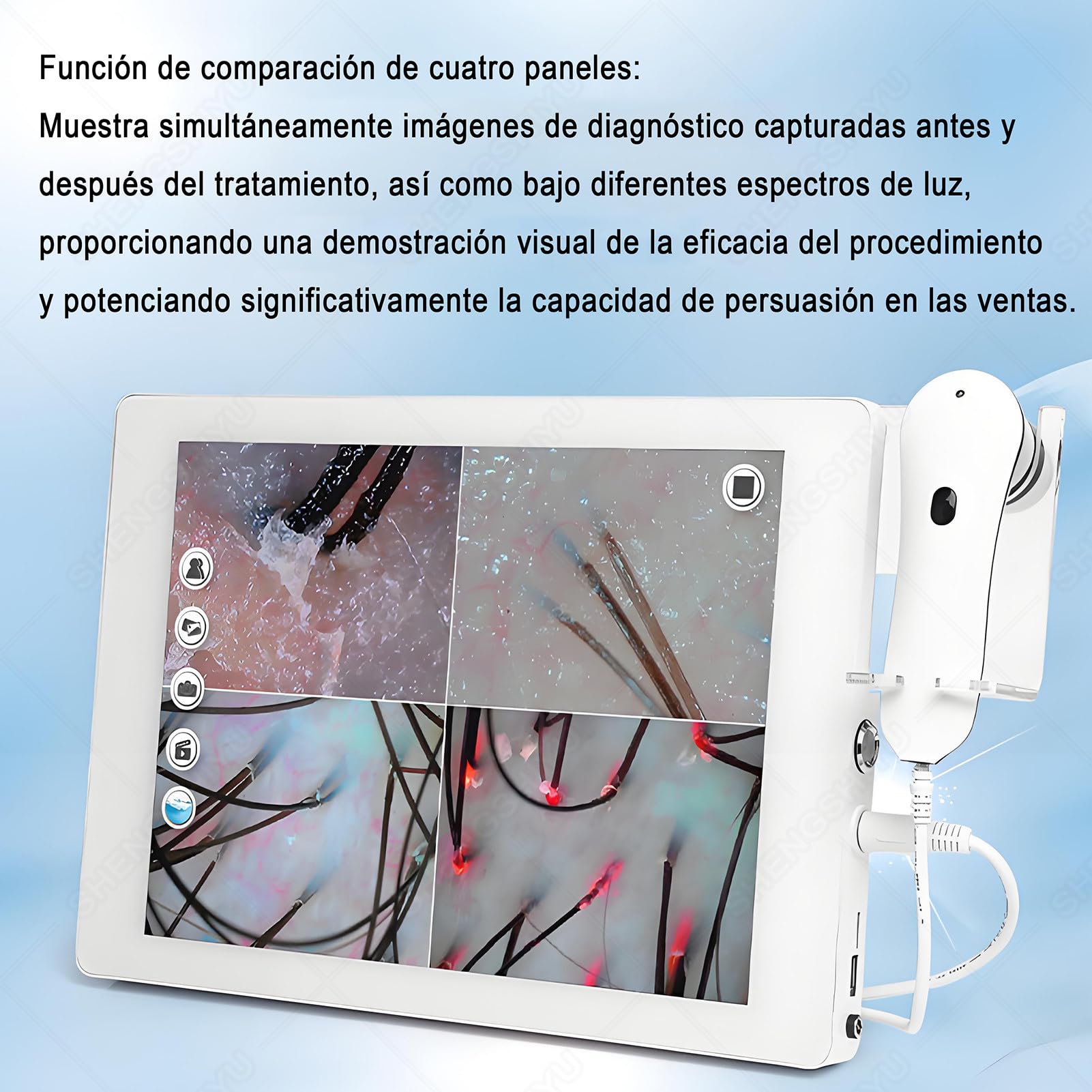 Haut Haar Analysegerät,Kopfhautanalysegerät mit 15 Zoll HD LCD Bildschirm für Haut Und Haaranalyse,32g,Dualobjektiv,Analysegerät Multifunktionaler Digitaler Hautpflege-Analysegerät