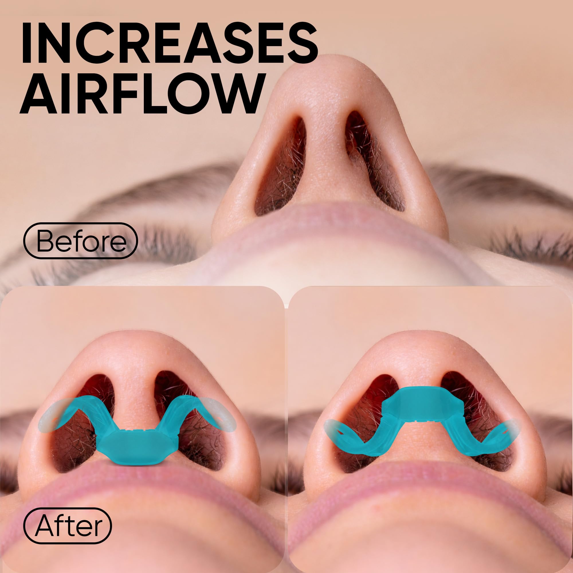 Brison Nasal Dilators for Breathing and Sleeping 2 Pack — Amazon image 4