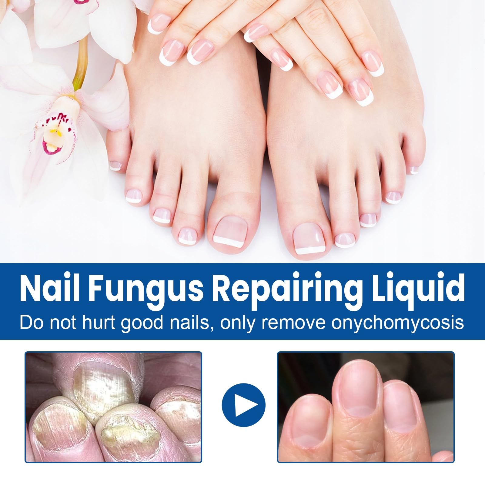 Nail Repair Oil, Extra Strong Nail Care Serum for Toenail, Nail Strengthener Oil, Fix & Renew Damaged - Image 4