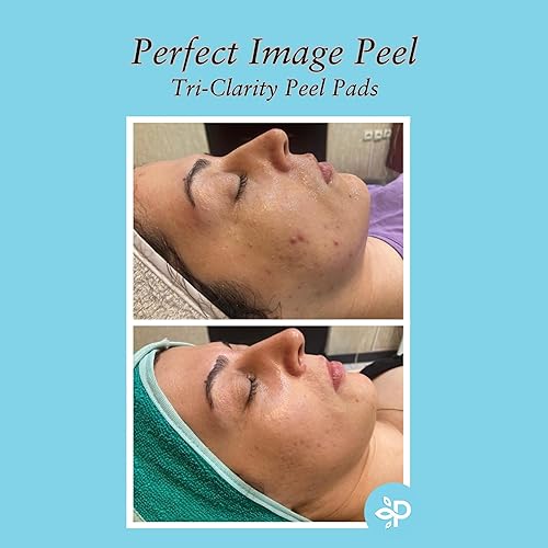 Miniatura 5 de Almohadillas de cáscara Tri-Clarity, mejoradas con ácido salicílico, ácido mandélico, aceite de árbol de té, extracto de té verde (25% de nivel de