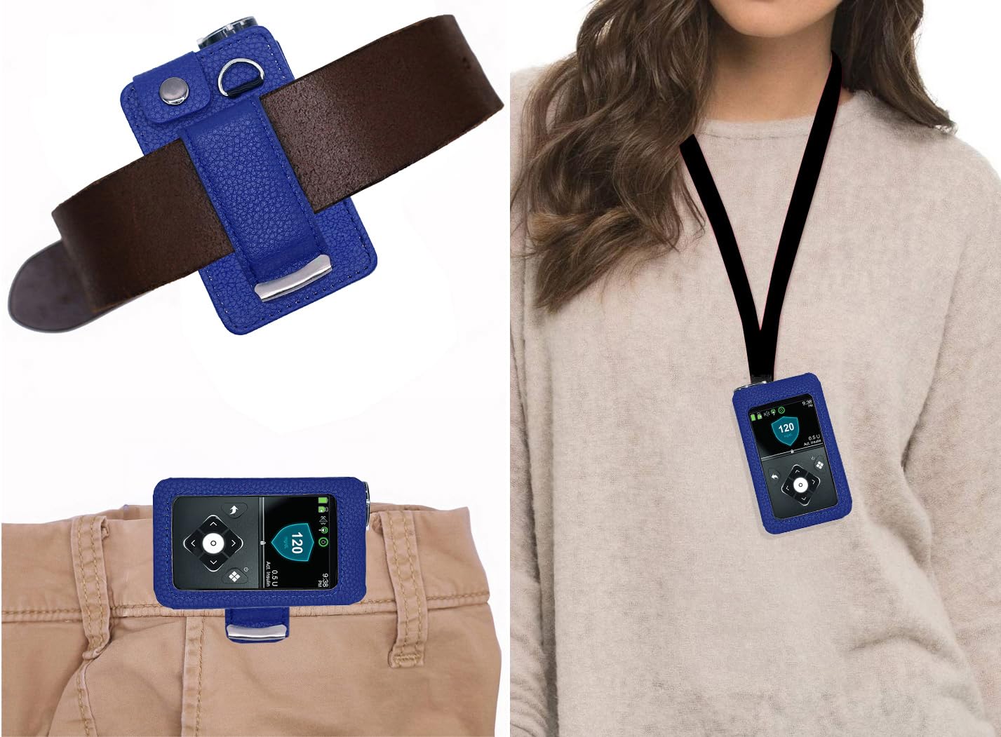 Étui en cuir ajusté avec clip de ceinture rotatif + protecteur d'écran pour pompe à insuline Medtronic Minimed (Minimed 630G / 640G / 650G / 670G / 770G / 780G) (Violet)