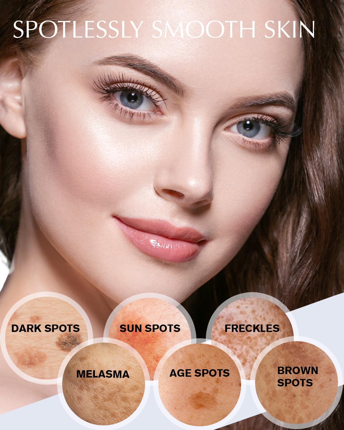 Hyperpigmentation Treatment - Natural Ingredient - Freckle/Melasma/Sun Spot/Age Spot Remover Dark Spot Corrector Cream