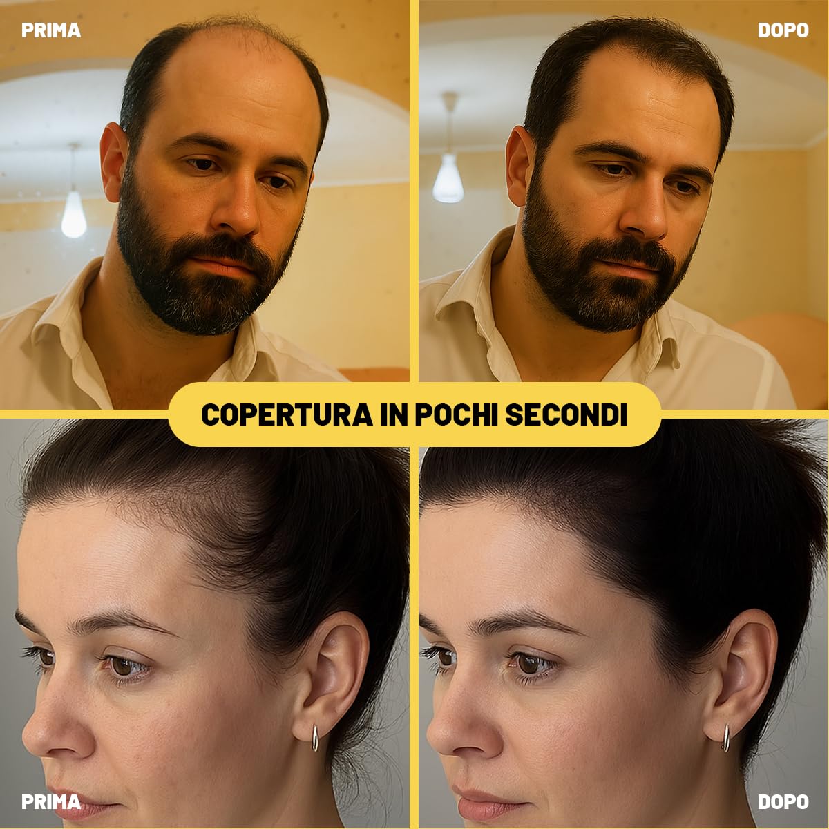HairFiberPlus Fibre per Capelli - Per Uomo e Donna - a Base di Cotone 100% Naturale - Polvere Volumizzante Copri Calvizie - Pronto in Pochi Secondi - 1 Confezione da 27,5g (Castano Scuro)