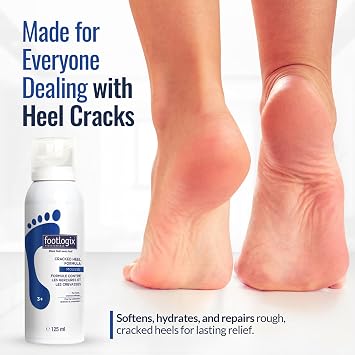 Footlogix Cracked Heel Formula Mousse 3+ 4.2 oz