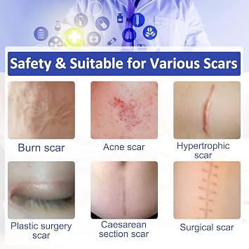 New Transparent Silicone Scar Sheets(1.6 x 120Inch - 3M),Away Scar Tape,Scar Strips, Reusable, Professional Scar Removal Sheets for C-Section, Surgery, Burn, Keloid, Acne et, Scar Patch.