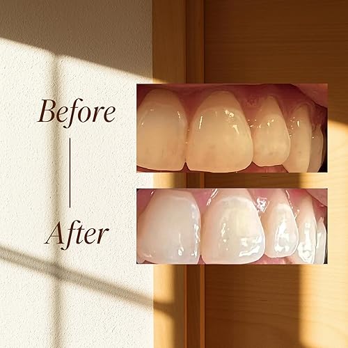 Miniatura 8 de Boka Pasta de dientes sin flúor - Nano hidroxiapatita, remineralizante, dientes sensibles, blanqueamiento - Recomendado por dentistas para el