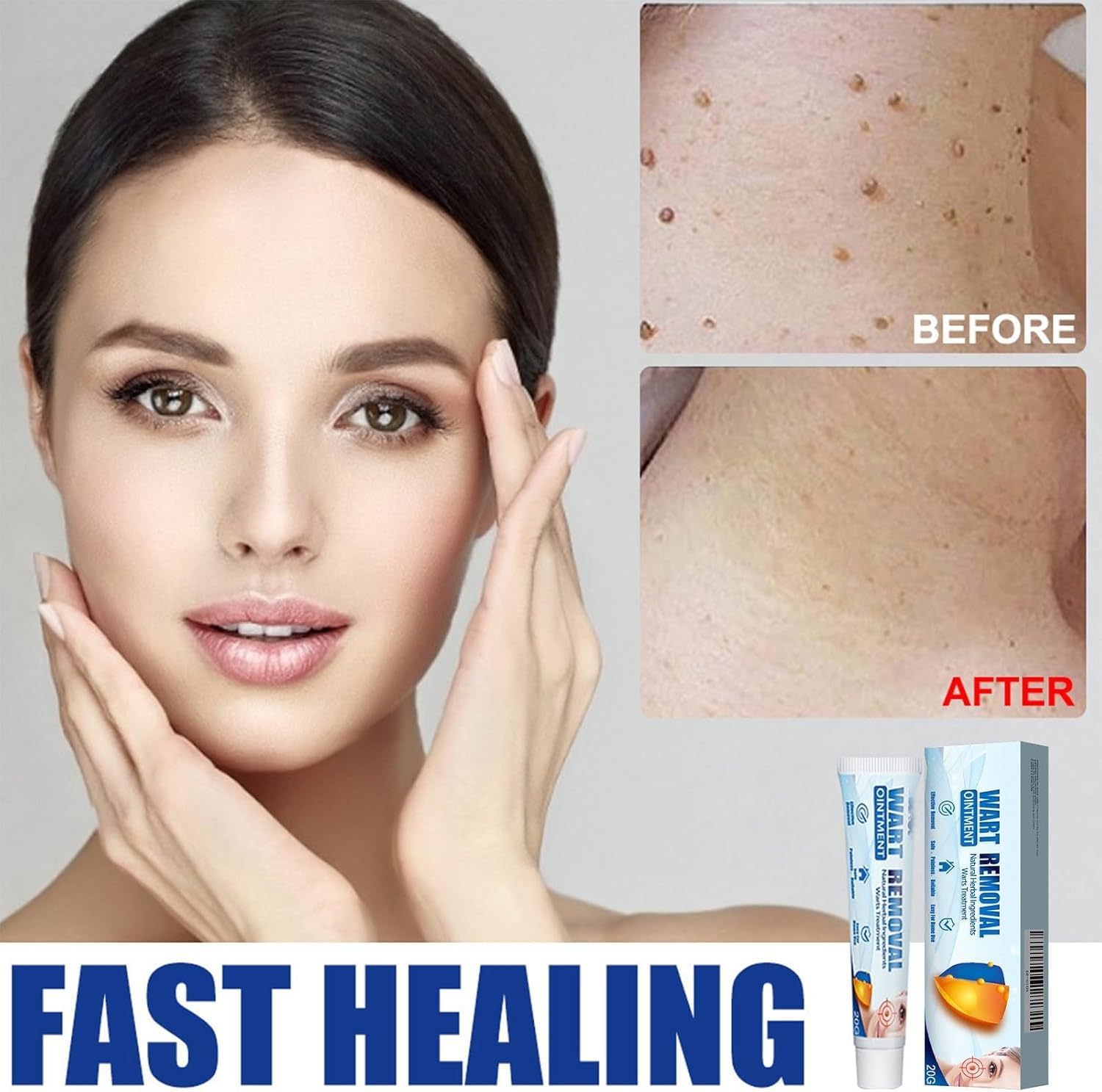 Fibromi Penduli Rimozione,Verruche Rimozione,Crema Per Eliminare Fibromi Penduli,Wart Removal Fibromo Pendulo Rimoziones,Crema Levigante Viso Corpo Mani Piedi (20g 3pcs) - 5