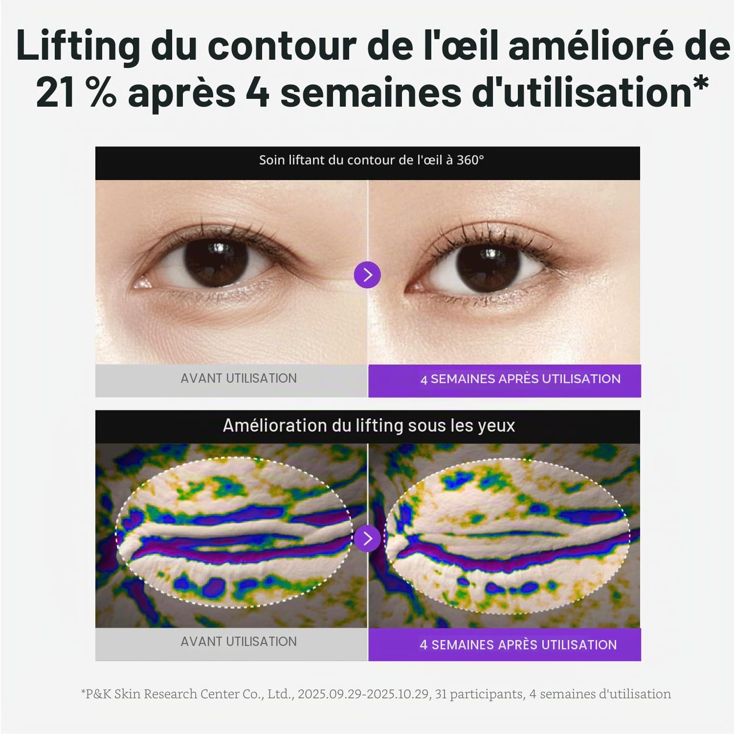 Centellian24 360 Shot PDRN Crème Raffermissante pour les Yeux 30 ml – Crème Contour des Yeux Anti-Âge au Rétinol pour les Yeux à Capuche, Lissage des Rides, Soin Hydratant Raffermissant