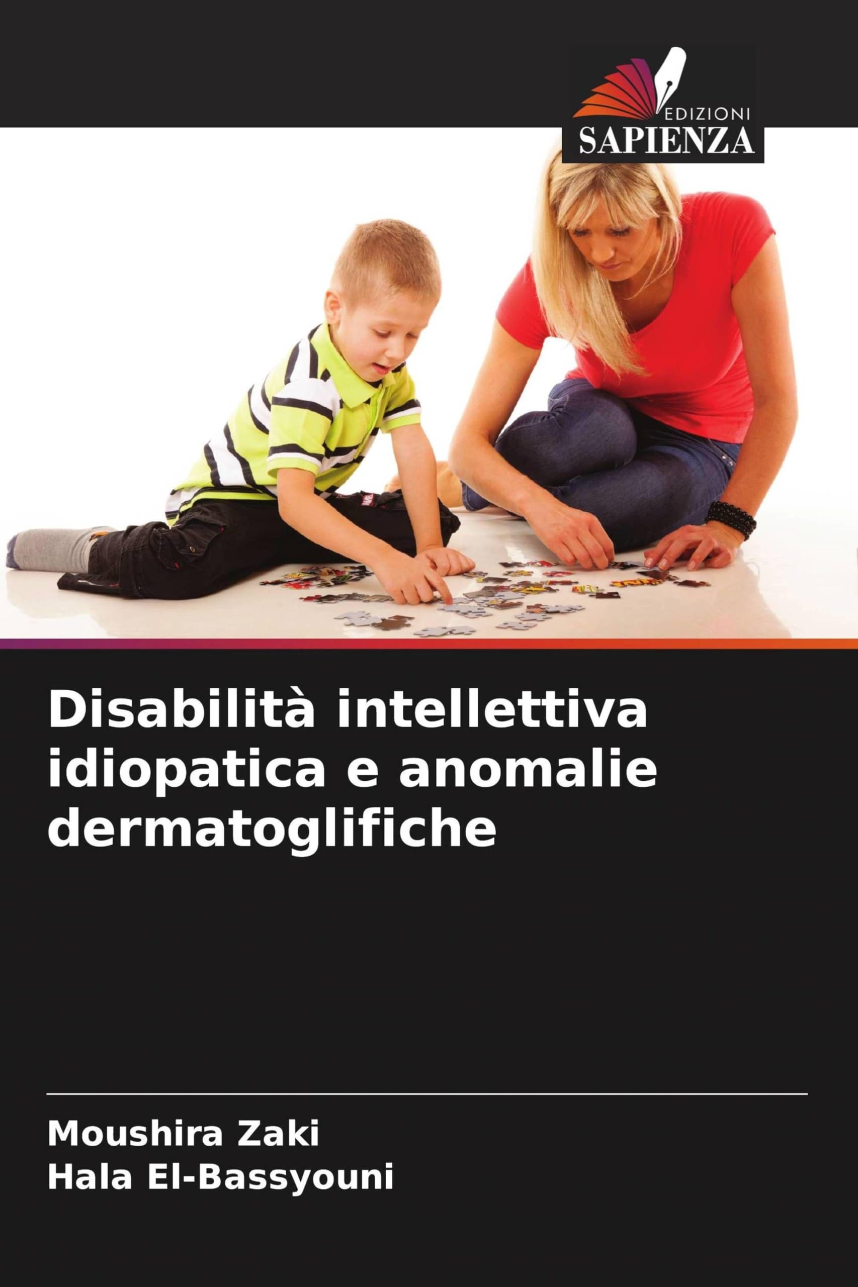 Disabilità intellettiva idiopatica e anomalie dermatoglifiche