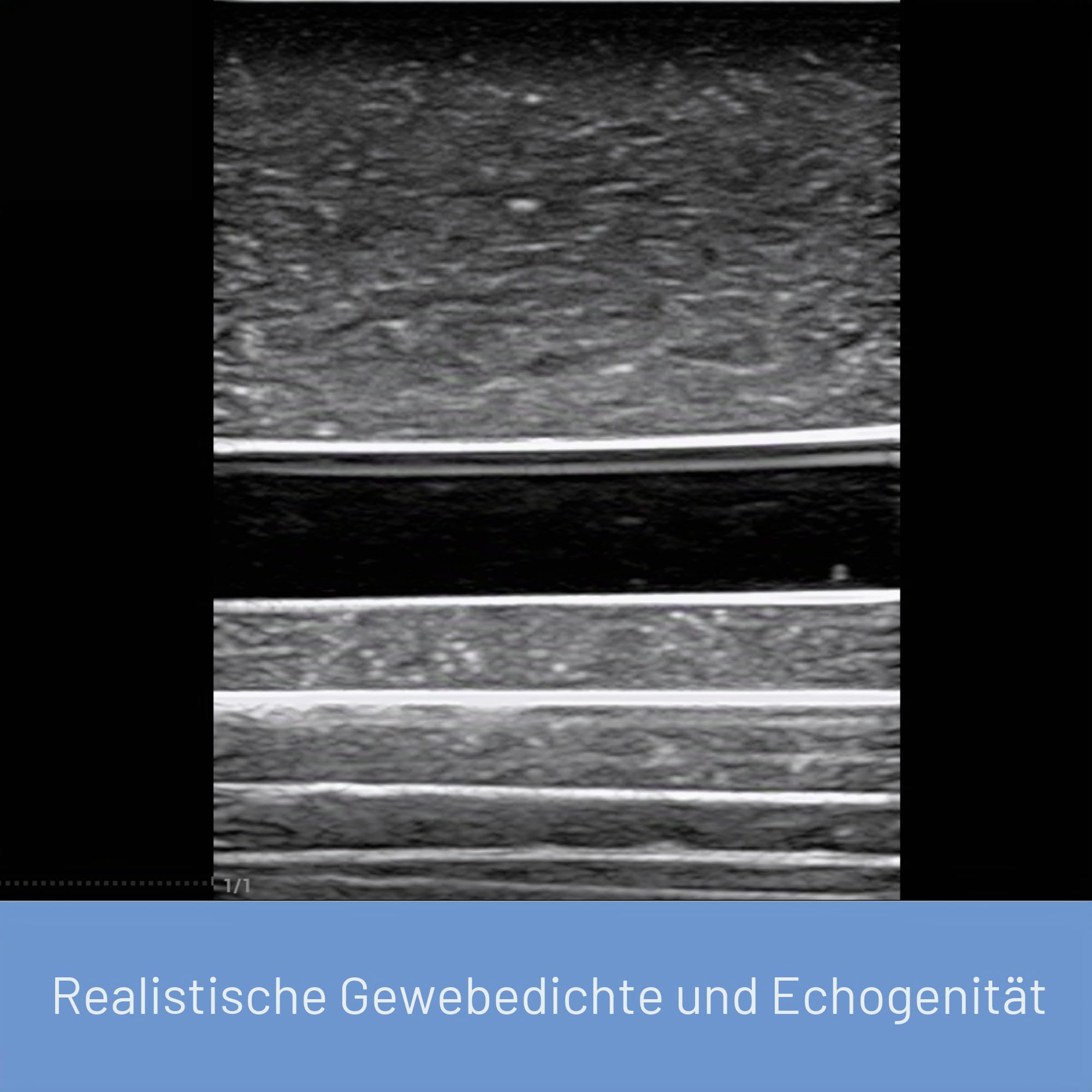 Ultraschall-Trainingspad – Ultraschall-Übungsmodell für Nadeleinführung, Gefäßsimulation, Trainingspad für medizinische Ausbildung