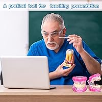 Vista 6 de Modelo de dientes con enfermedad de Outus, modelo de implante dental con dientes removibles, estándar de dientes patológicos para demostración