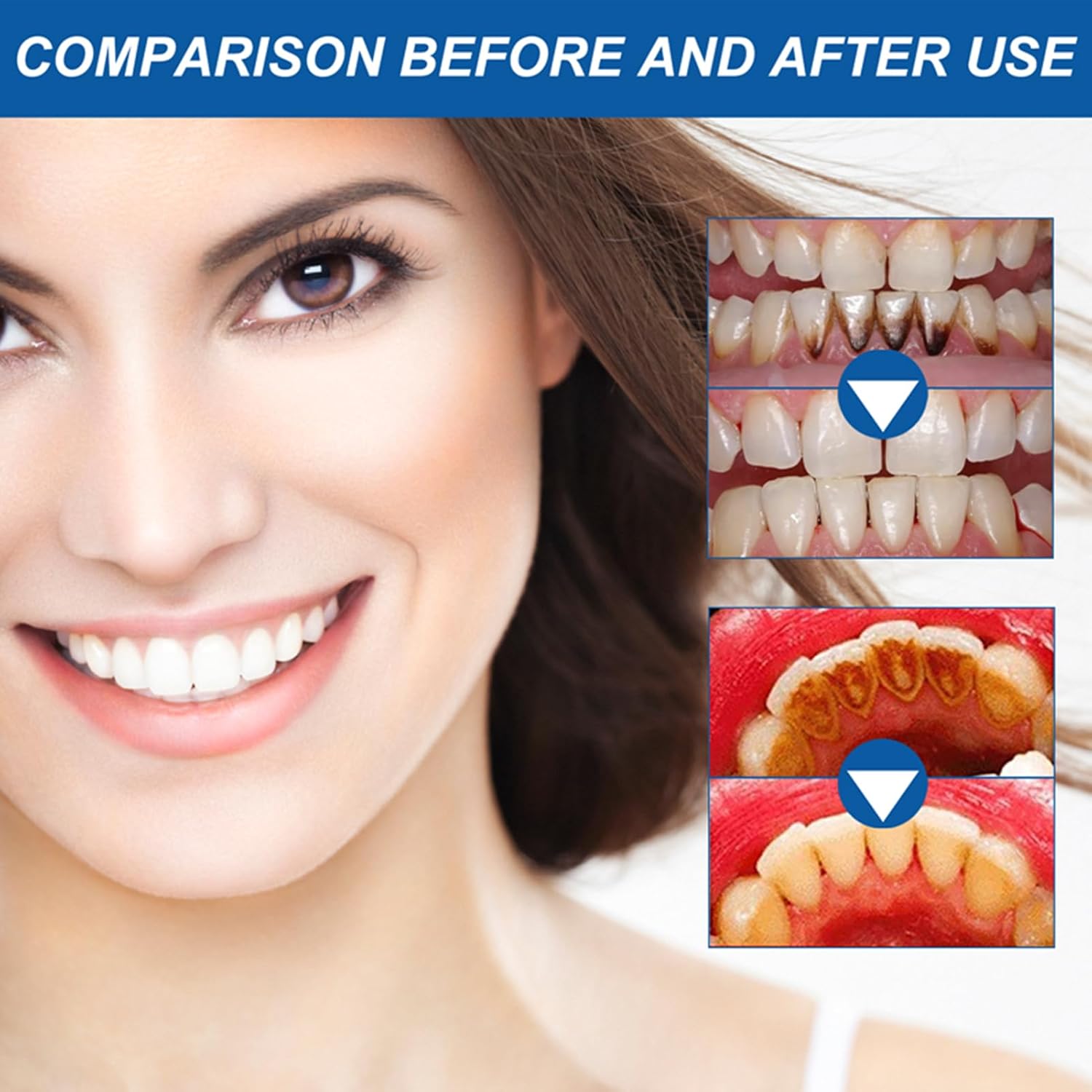 Mullend Gum Repair Gel, Qylen Gum Repair Gel, Gum Instant Treatment Teeth Whitening Essence Pen Reduce Yellowing Oral Care (2)