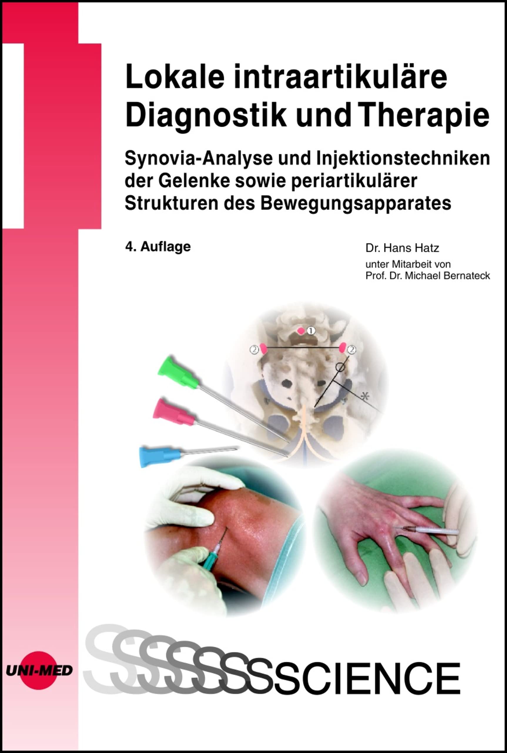 Lokale intraartikuläre Diagnostik und Therapie (UNI-MED Science)