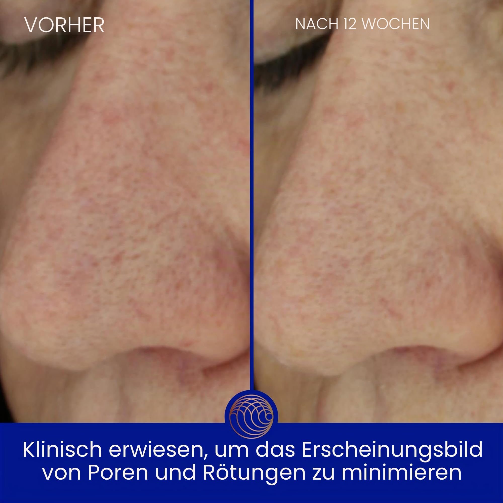 Augustinus Bader The Light Cream (30ml)