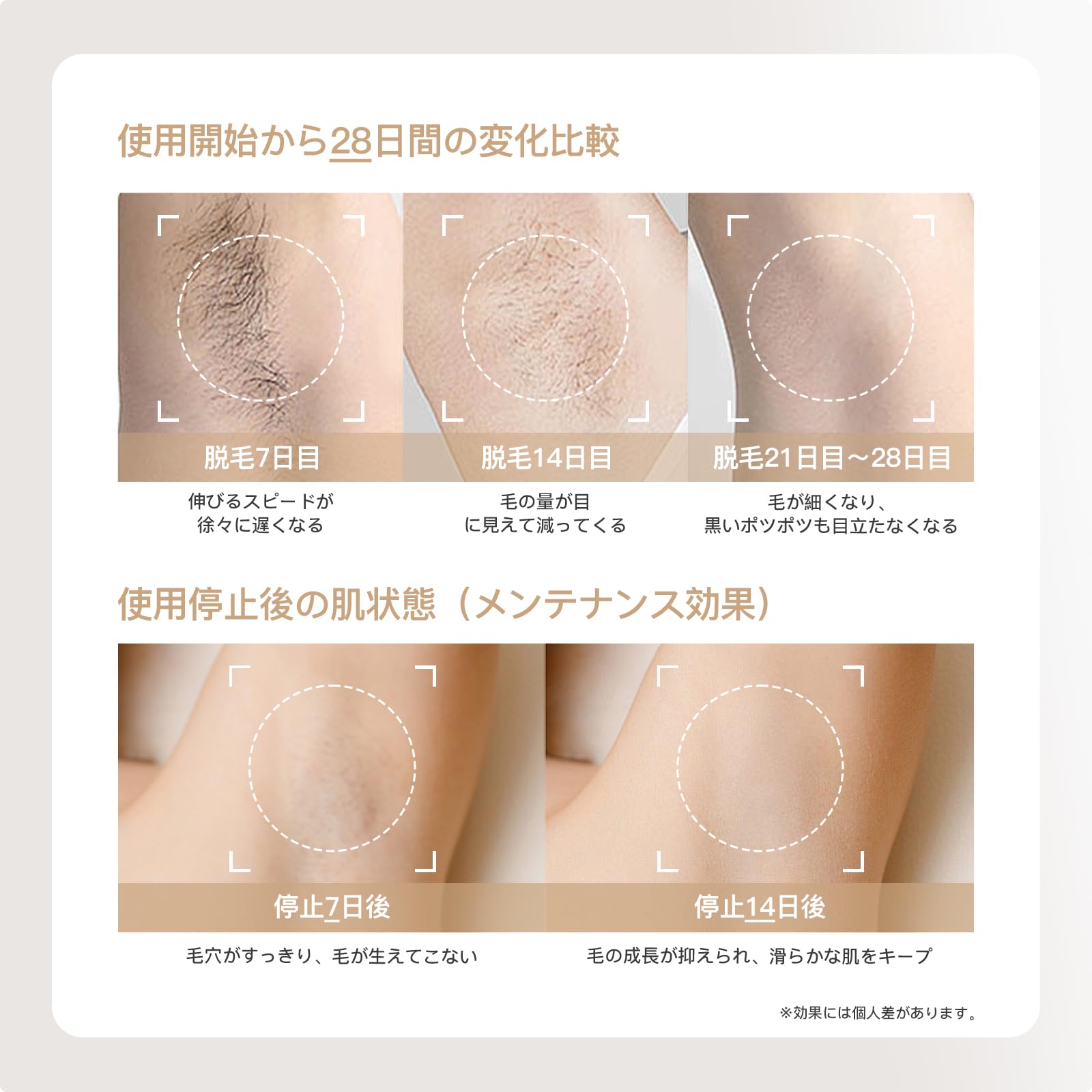 Amazon | YETE 脱毛器 サファイア冷感 家庭用光脱毛器 VIO対応 男女