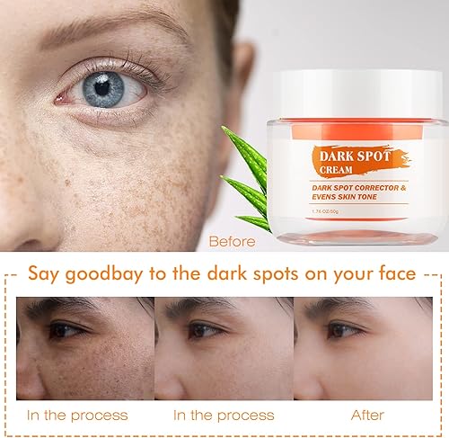 Miniatura 7 de Tónico para manchas oscuras, tóner corrector de manchas oscuras, tóner facial para piel propensa al acné, removedor de manchas oscuras para la cara