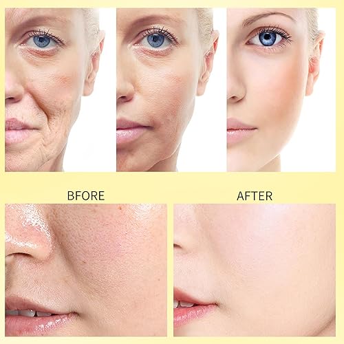 Miniatura 5 de Suero facial de retinol para la cara, hidrata el suero facial del cuidado de la piel para todo el tipo de piel 1.0 fl oz