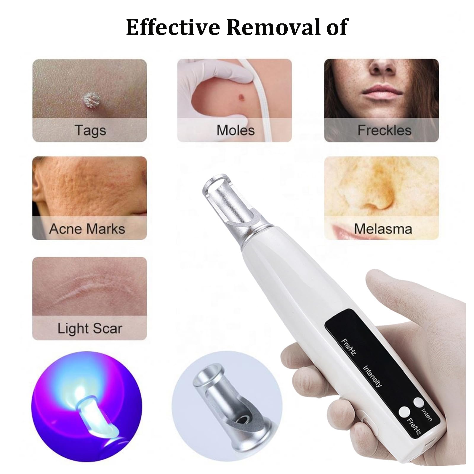 Picosecond Laser Pen, pióro do usuwania narośli skórnych, niebieskie i czerwone światło, wyświetlacz LCD, z 9 trybami, 4 poziomami usuwania przebarwień,blizn,znamion,ciemnych plam,piegów,Blue