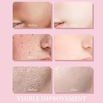Grospe Centella Clay Mask Stick, Clay Face Mask Moisturizing & Nourishing, Deep Cleansing Poremizing Mud Mask for Pores for All Skin Types (30ml)