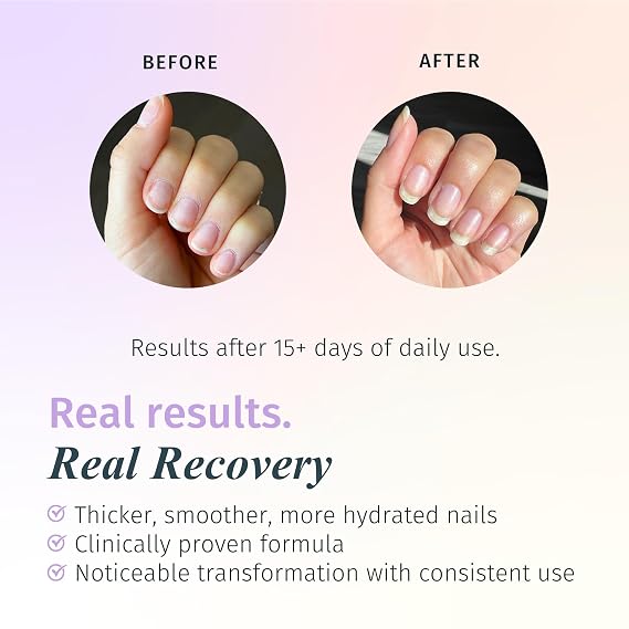 Duri Rejuvacote 2 Nail Growth Base and Top Coat, Balanced Repair - Nail Hardener for peeling, thin, or fragile nails (Pack of 1)