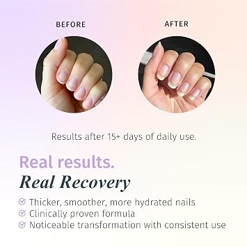 Duri Rejuvacote 2 Nail Growth Base and Top Coat, Balanced Repair - Nail Hardener for peeling, thin, or fragile nails (Pack of 1)