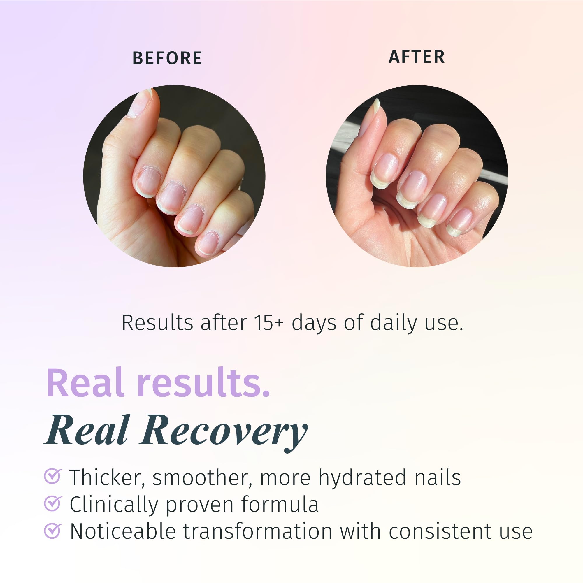 Duri Rejuvacote 2 Nail Growth System Base and Top Coat, 13.3 ml.