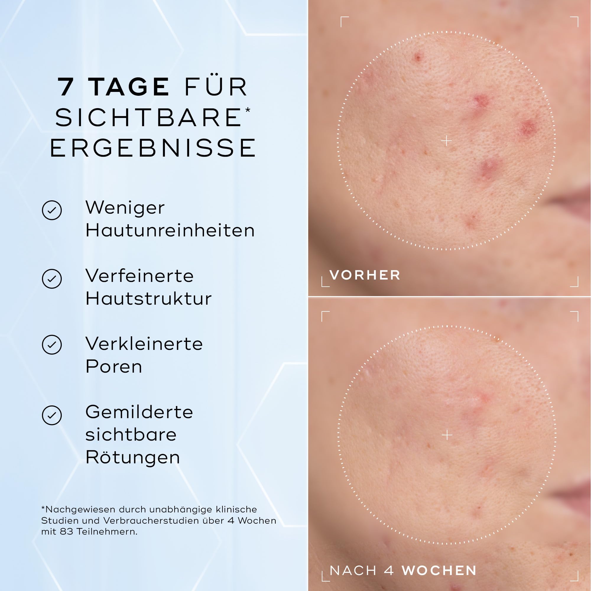 Medik8 Niacinamide Peptides, Verfeinerndes 10% Niacinamid-Serum - 30 ml | Ausgleichend & porenverfeinernd mit Peptiden & NAG – glatterer Teint und Hauttextur, für die Hautbarriere, gegen Unreinheiten