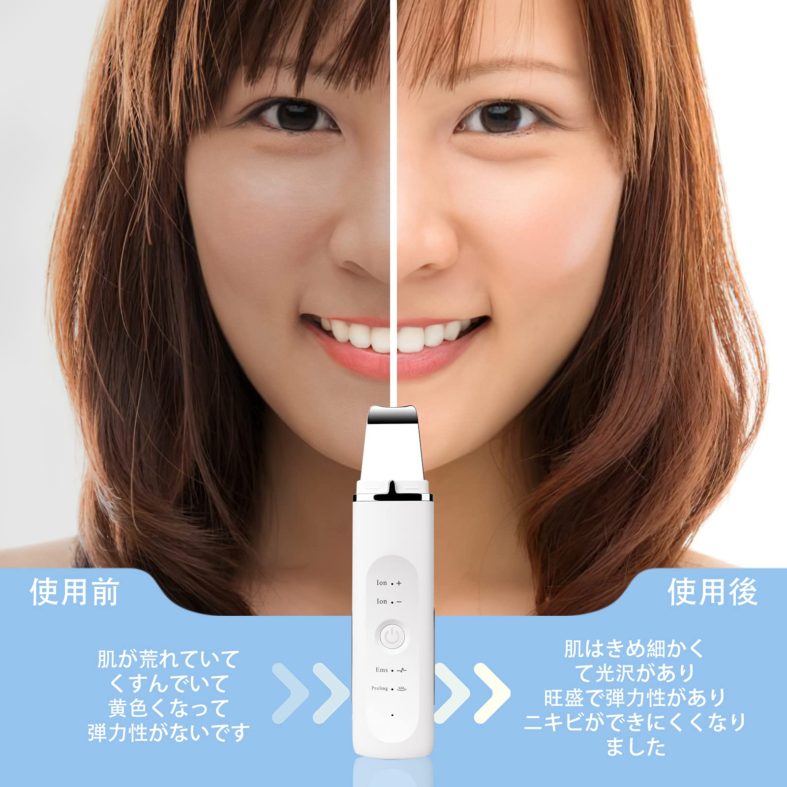 Amazon.co.jp: 【Amazon限定ブランド】ウォーターピーリング 超音波