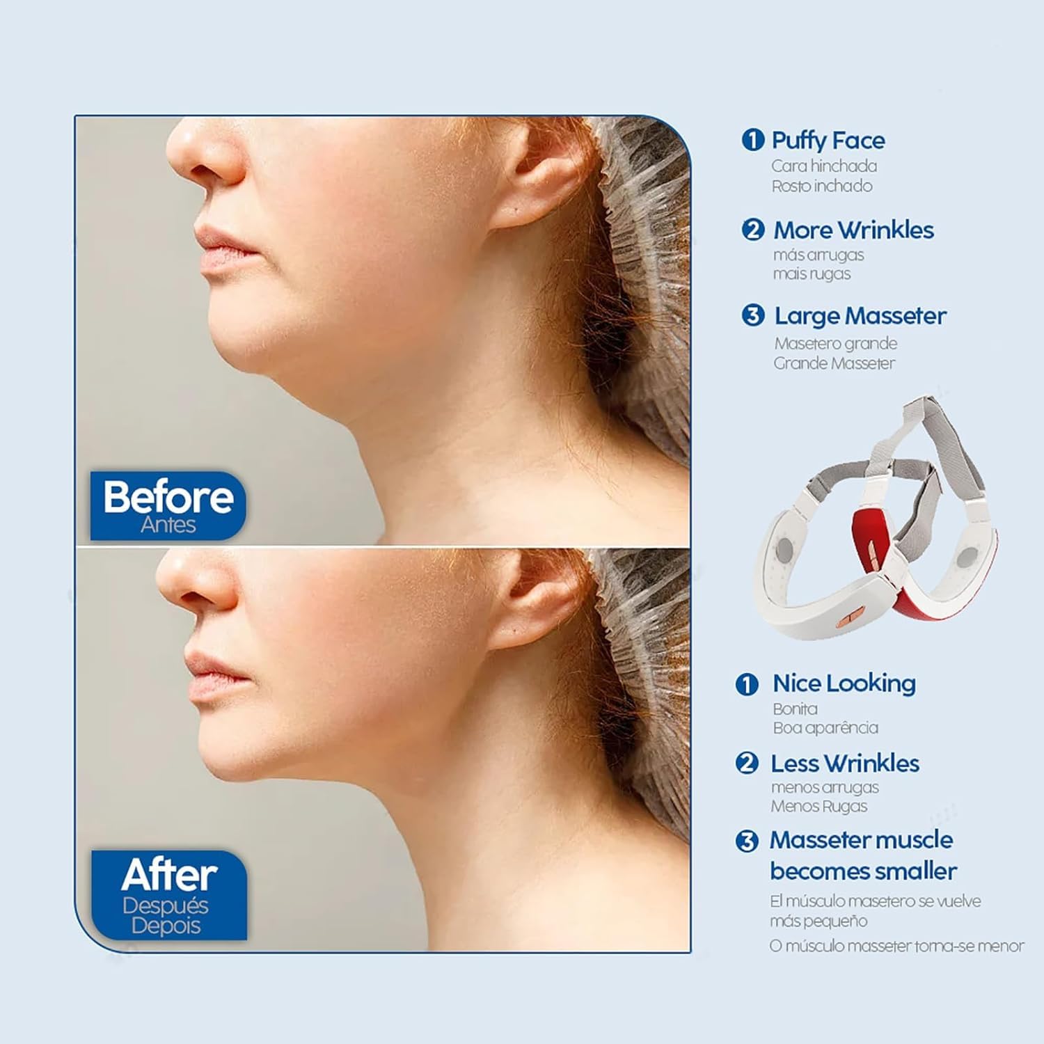 ERICAT Dispositivo De Adelgazamiento Facial, Máquina Reductora De Papada con Mando a Distancia Y Pantalla De Visualización, 6 Modos Y Niveles De Intensidad Ajustables, para Oficinas, Hogares