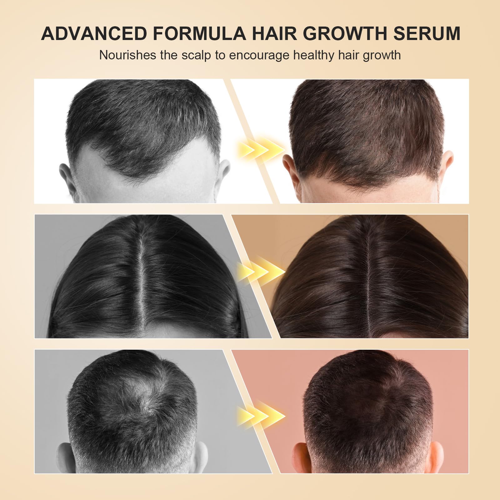 Hair Growth Serum naturalna pielęgnacja włosów do skóry–3x60ml | z olejkiem rozmarynowym,olejem rycynowym i biotyną serum do włosów przeciw wypadaniu włosów dla mężczyzn i kobiet