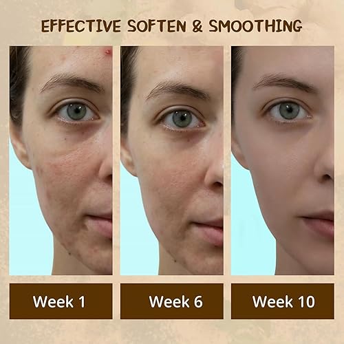 Miniatura 3 de Jabón de limón