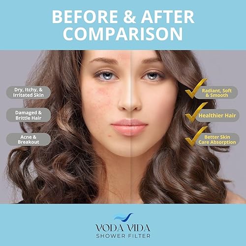 Miniatura 2 de Filtro de ducha para agua dura | Filtro de cartucho de ducha de 15 etapas (1 paquete de repuesto de cartucho)