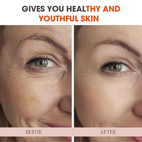 Miniatura 6 de Suero súper vitamina C para mujeres mayores de 70 años, paquete total todo en uno, suero facial para piel madura, hidratante, levantamiento,