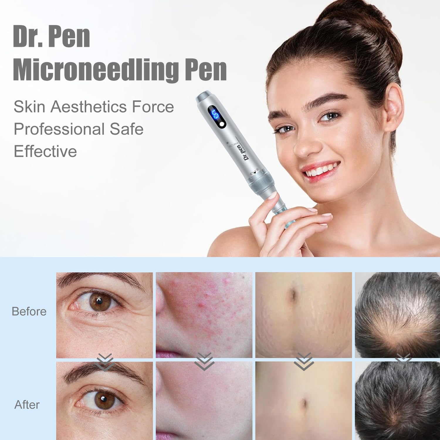 Dr. pen Ultima M7S Microneedling Pen - bezprzewodowy długopis do mikronakłuwania elektryczny Derma Pen do pielęgnacji twarzy, ciała i skóry, długopis do mikronakłuwania - z 27 wkładami(Srebrny)