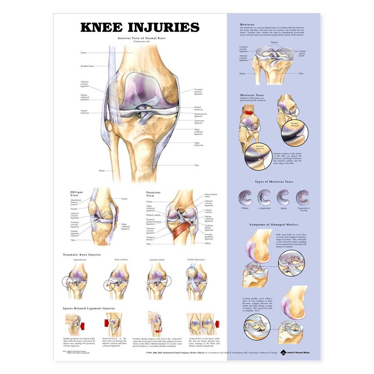 Knee Injuries Anatomical Chart      Wall Chart – January 9, 2003