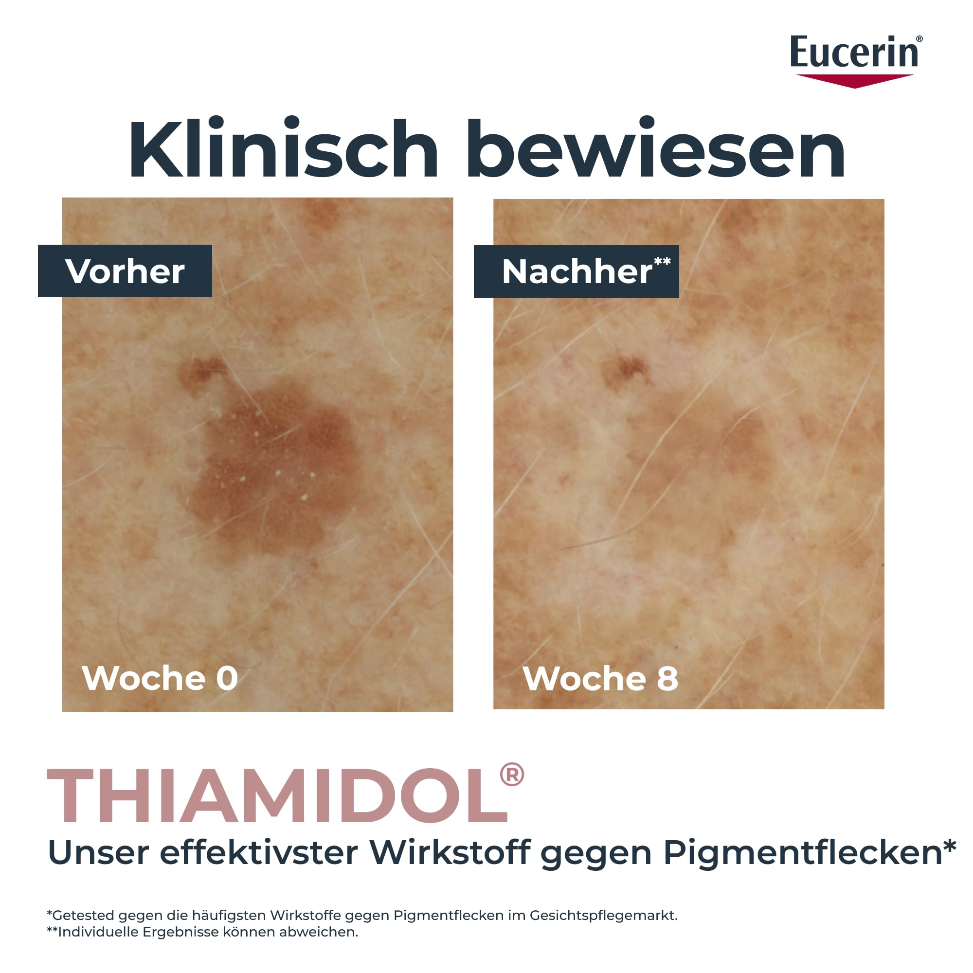 Eucerin Anti-Pigment Korrekturstift 5 ml, Serum-Applikator für die gezielte Behandlung gegen Pigmentflecken, nicht-fettendes Gel mit Thiamidol