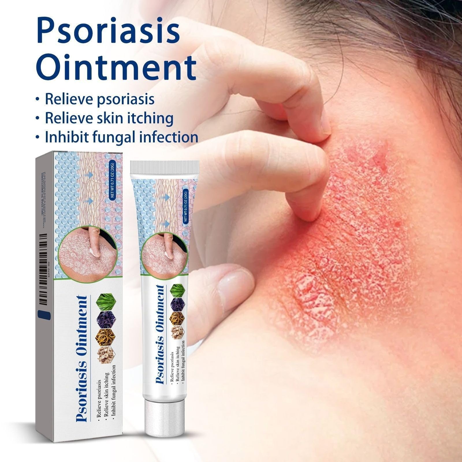 Crèmes Contre Le Psoriasis, Crème à Base De Plantes, Pour le Corps, creme intense, Apaise les Cutanées, Soulagement efficace des démangeaisons Le Pour Réduit Des Démangeaisons