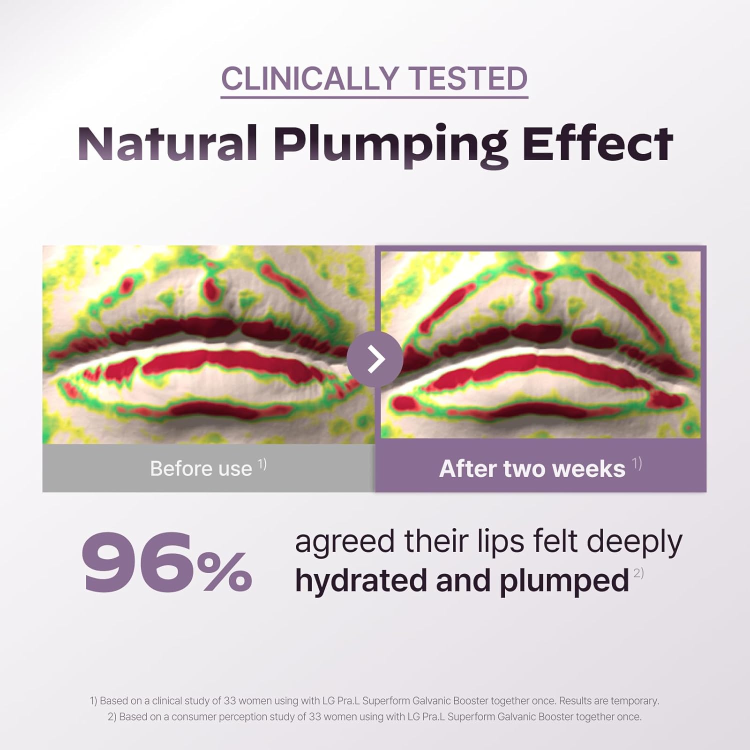 GLASSLIKE Moisture Plumping Vita Lip Serum, revitalizing and volume care for lip, Moisture Plumping Hypoallergenic Lip care, Glass-like Lip - 0.33 fl.oz - Image 4