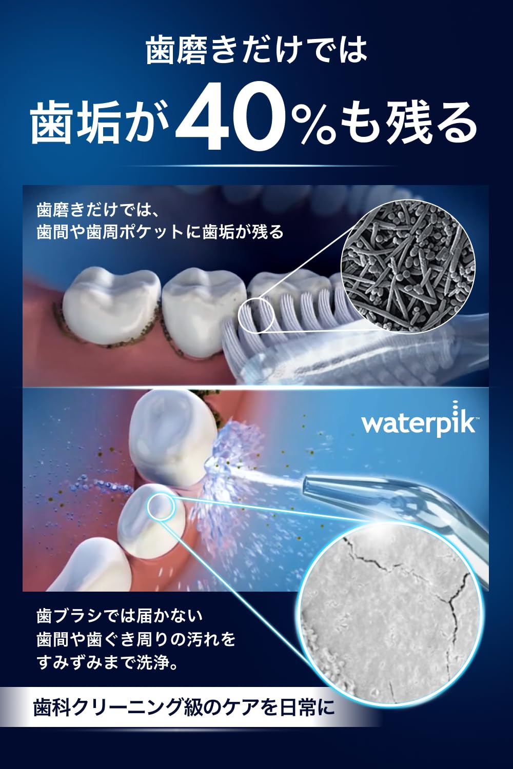 Amazon.co.jp: waterpik ウォーターピック 特別チップセット【正規品
