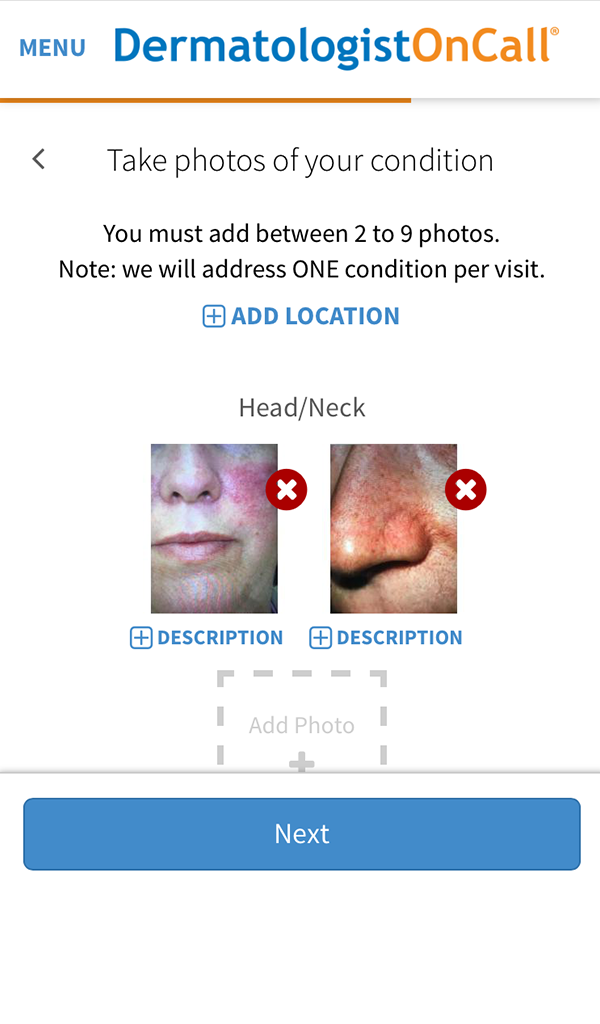 DermatologistOnCall - Online Dermatology Care - App on Amazon Appstore