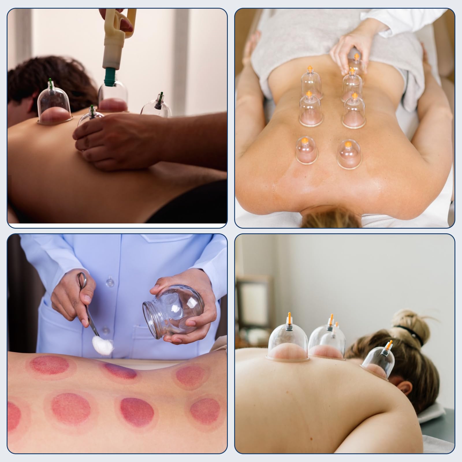 Lot de 22 ventouses en verre – Set de ventouses en plastique avec pompe à vide, ventouses pour massage, ventouses, dos, nuque, anti-cellulite, accessoires de thérapie