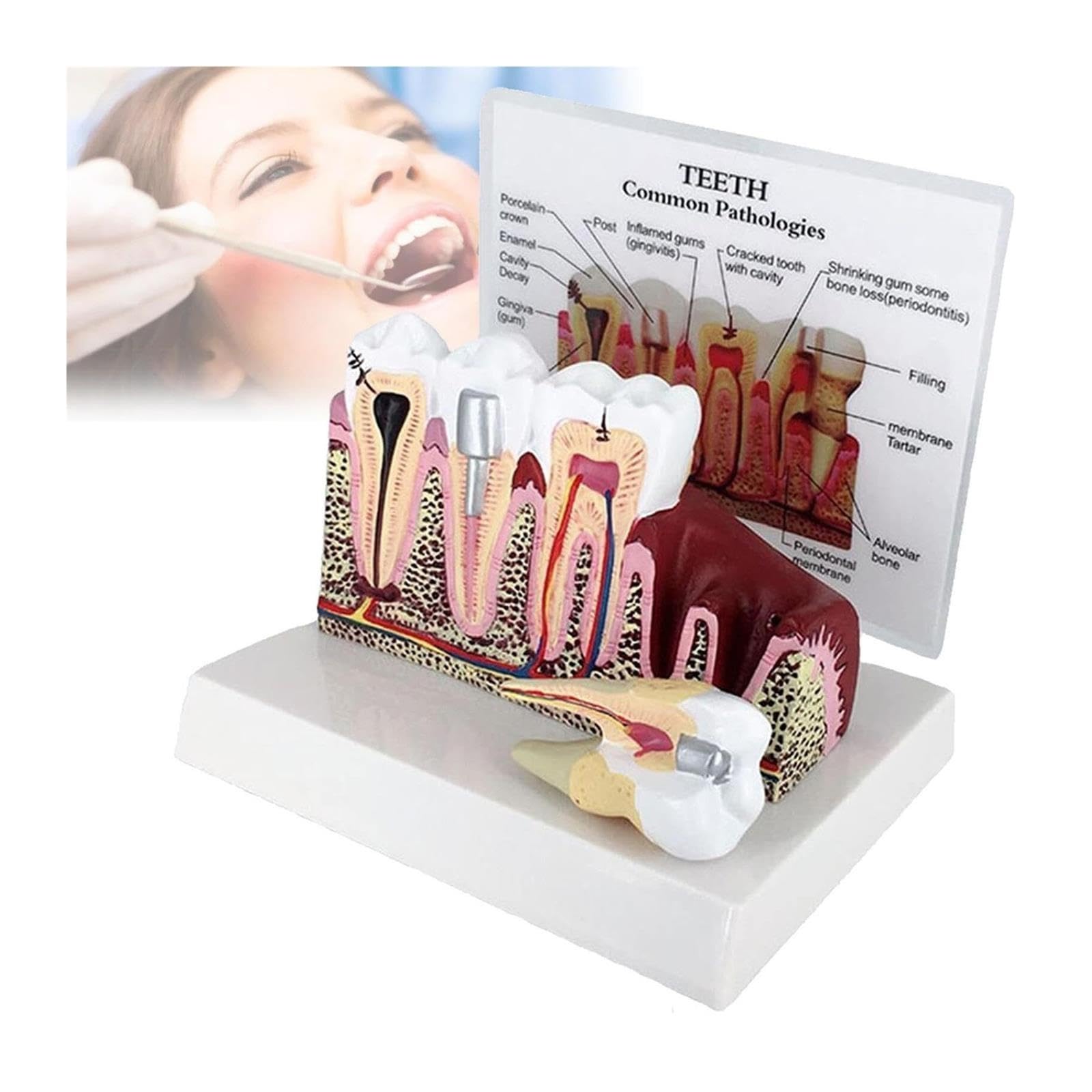 Anatomia dentale Educazione Modello Dente