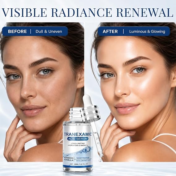 Tranexamic Acid Serum, Brightening Face Serum, Dark Spot Correcting Serum