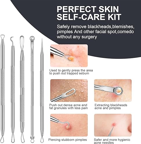Miniatura 5 de Kit de herramientas para reventar espinillas, kit extractor de comedones con caja para eliminar fácilmente puntos negros, acné, manchas, puntos